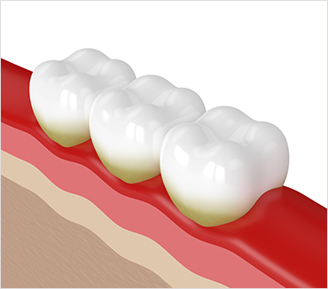 Medford Dentist: Benefits of Straight Teeth Main Street Family